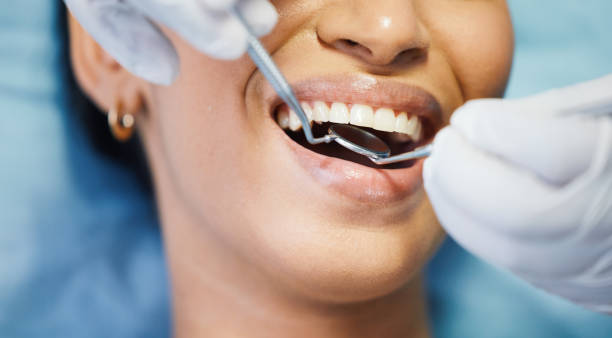 Best Emergency Denture Repair in Patterson, CA