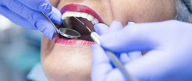 Best Emergency Tooth Extraction in Patterson, CA
